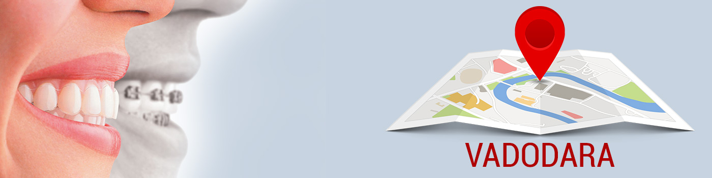 Teeth Whitening clinic